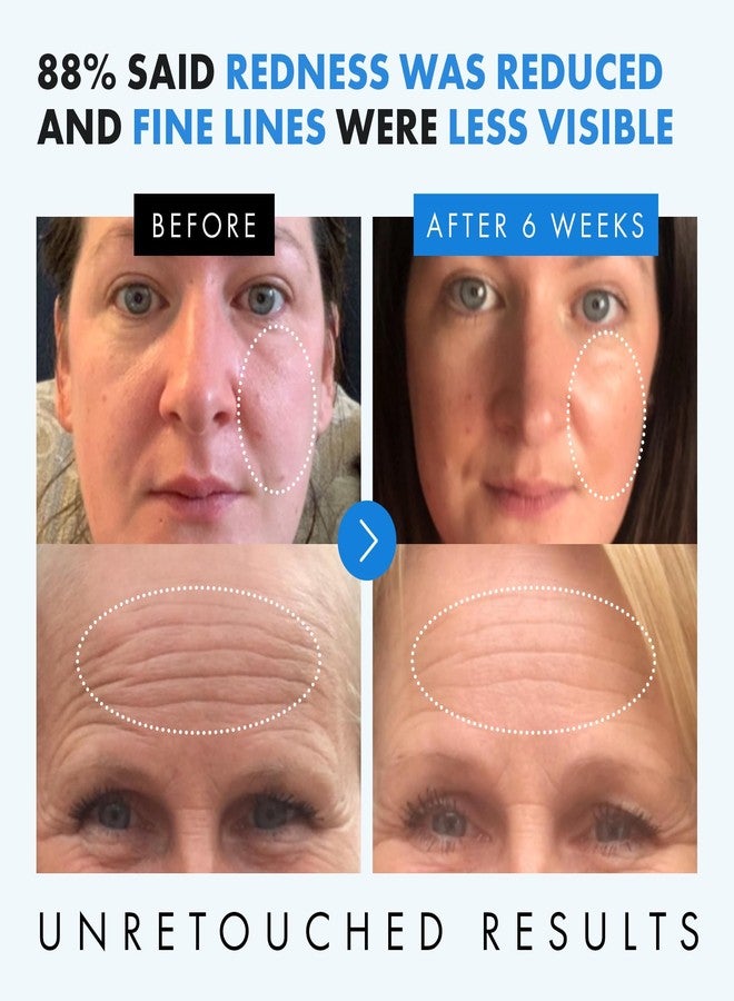 Eclat Skincare سيروم هيالورونيك أسيد للعناية بالبشرة من إكلا - 2.5% هيالورونيك أسيد + 3% ب5، فيتامين سي وإي - سيروم مرطب مضاد للشيخوخة والتجاعيد للوجه - تركيبة مرطبة وممتلئة للبشرة الناعمة 1 أونصة سائلة - Image 3