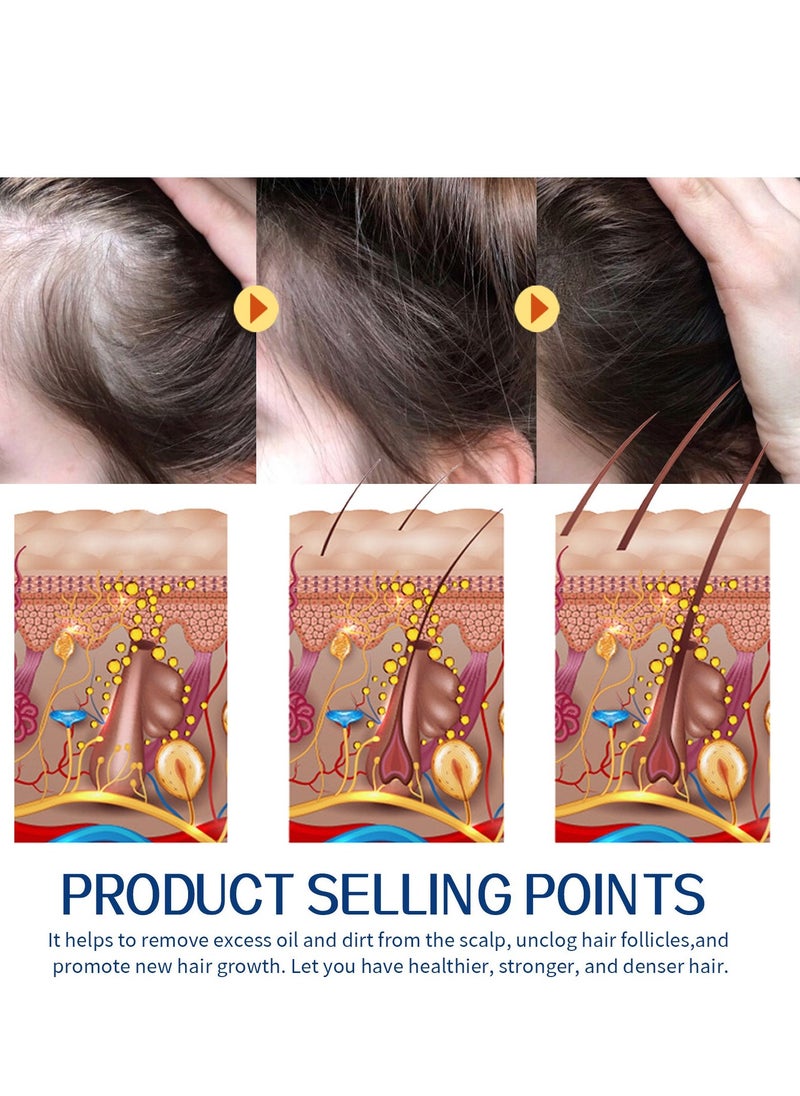 EELHOE Exfoliating Scalp Scrub, Dandruff Itch Treatment, Hair Detox Scrub, Sulfate-Free Scrub Soothes Dry, Flaky, Itchy Scalp, Removes Buildup - Image 3