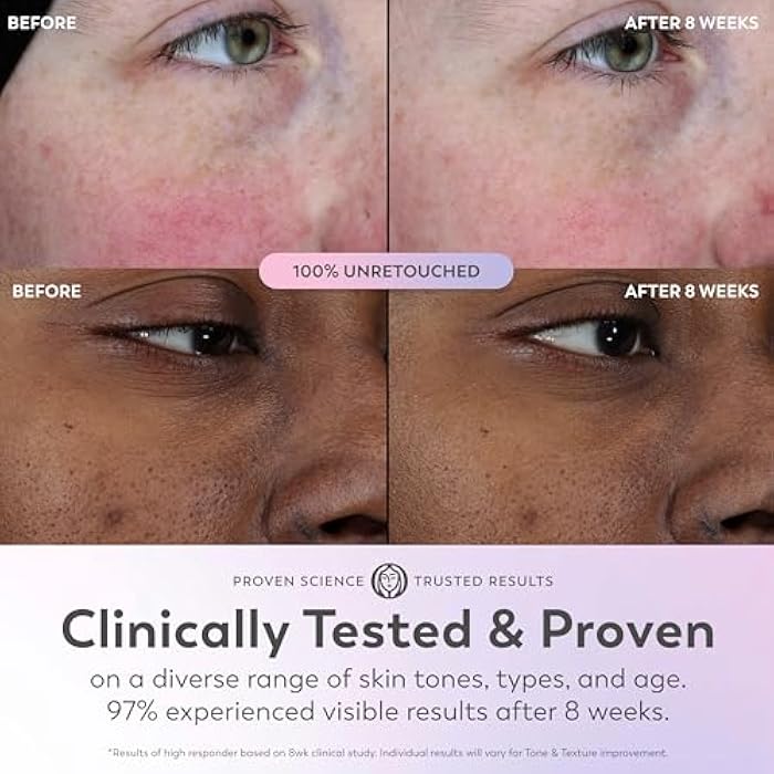 Olay Super Serum - Niacinamide, Vitamin C & E, Collagen Peptide, AHA - 5-in-1 Skin Care Benefits for Face - Healthy Glow, Brightening, Hydrating, Smoothing, Firming, Evens Tone, Anti-Aging, 1.0 Oz - Image 5