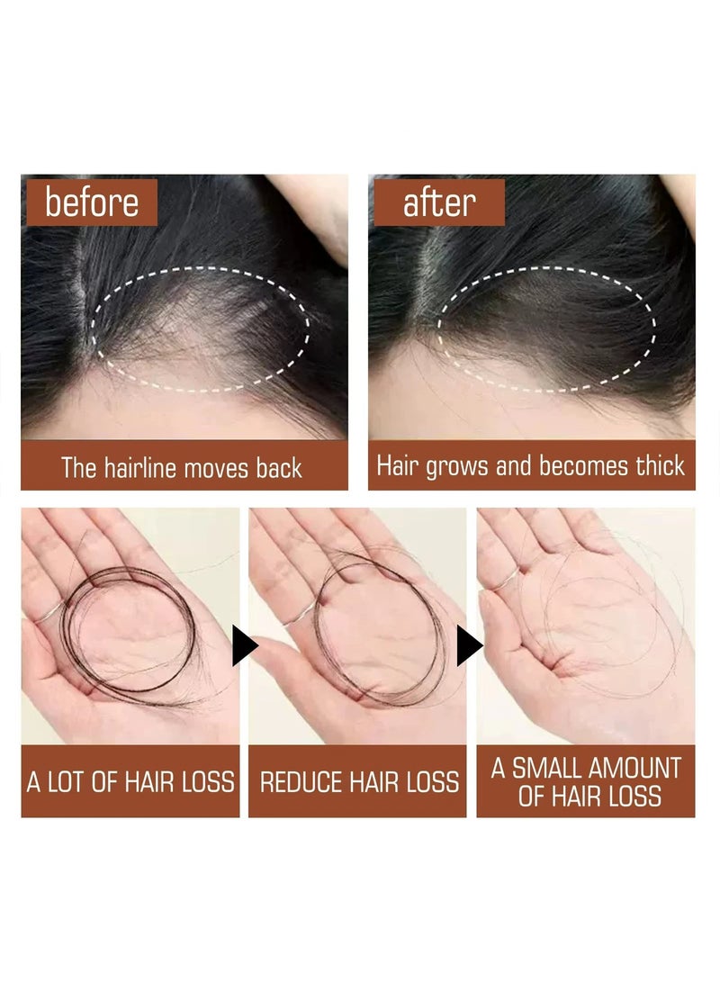 إيلهو زيت باتانا لنمو الشعر المعزز والقوة 100% غير مكرر، يزيد من كثافة الشعر ويجعله أكثر صحة، علاج شعري عضوي 120 مل / 4.05 أونصة سائلة - Image 4