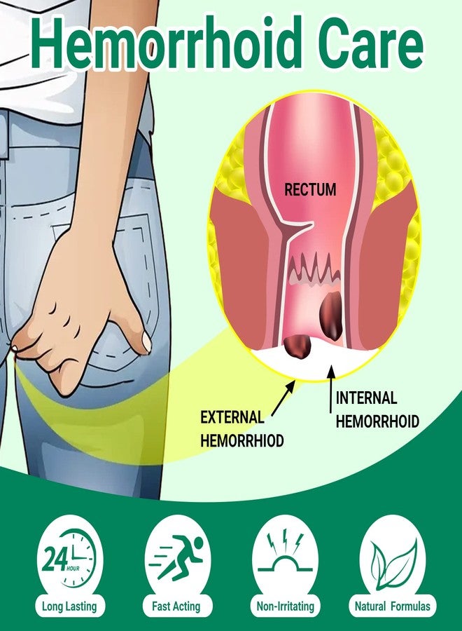 لمنوب مرهم LMNOOP® لعلاج البواسير، علاج فائق القوة وتسكين سريع للألم والحكة والحرق والتورم والشقوق والنزيف وعدم الراحة، كريم طويل الأمد للبواسير الداخلية والخارجية - Image 4