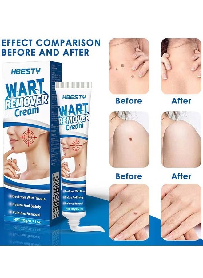 HBESTY Natural Herbal Wart Remover Cream, Gentle Formula for Warts, Corns, Calluses, 20g - Image 3