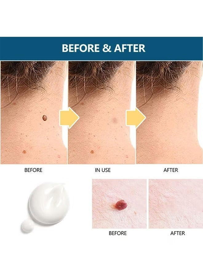 HBESTY Natural Herbal Wart Remover Cream, Gentle Formula for Warts, Corns, Calluses, 20g - Image 4