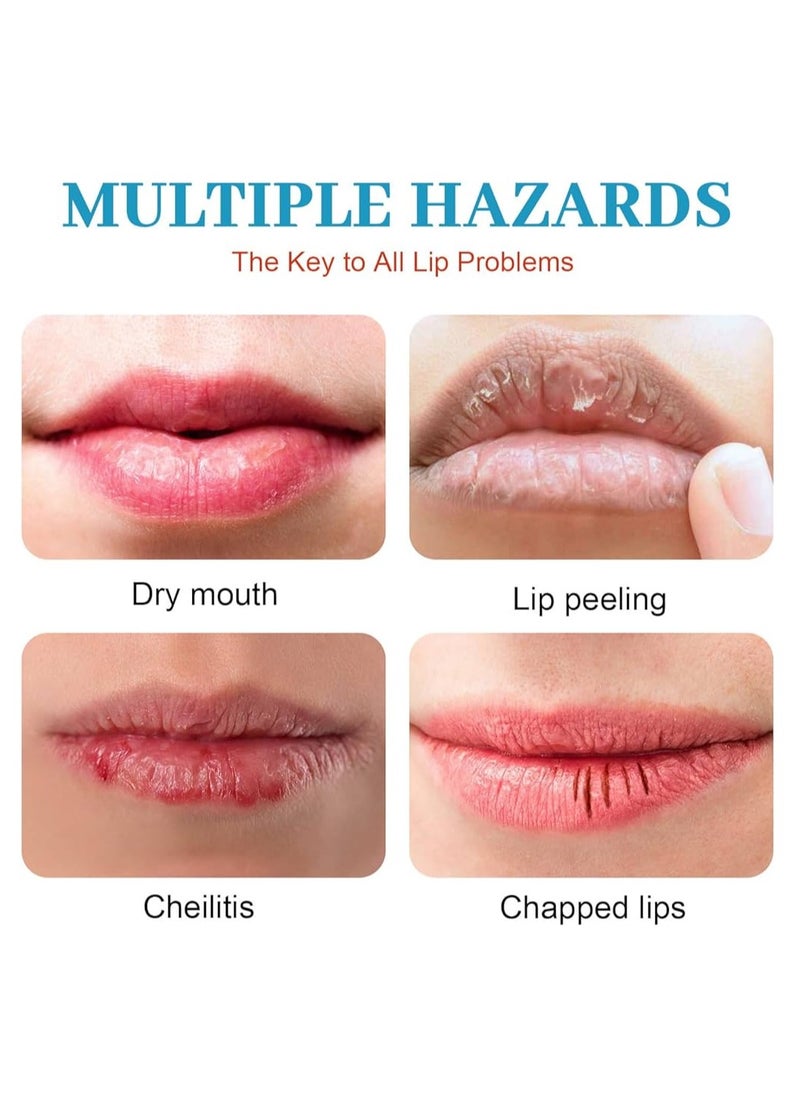 HEALMUSZ - Lip Repair Gel Youthful Lip Replenishes Ultimate Solution for Youthful Lips Fade Lip Lines Deeply Nourishes Moisturizes Lips Exfoliate Repair Cream 20g - Image 1