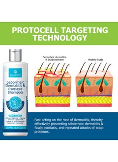 Roycederm Oycederm Psoriasis Shampoo Seborrheic Dermatitis Shampoo Folliculitis Shampoo Dandruff Shampoo Scalp Psoriasis Treatment Seborrheic Dermatitis Treatment Dry Itchy Scalp Treatment  - Image 5