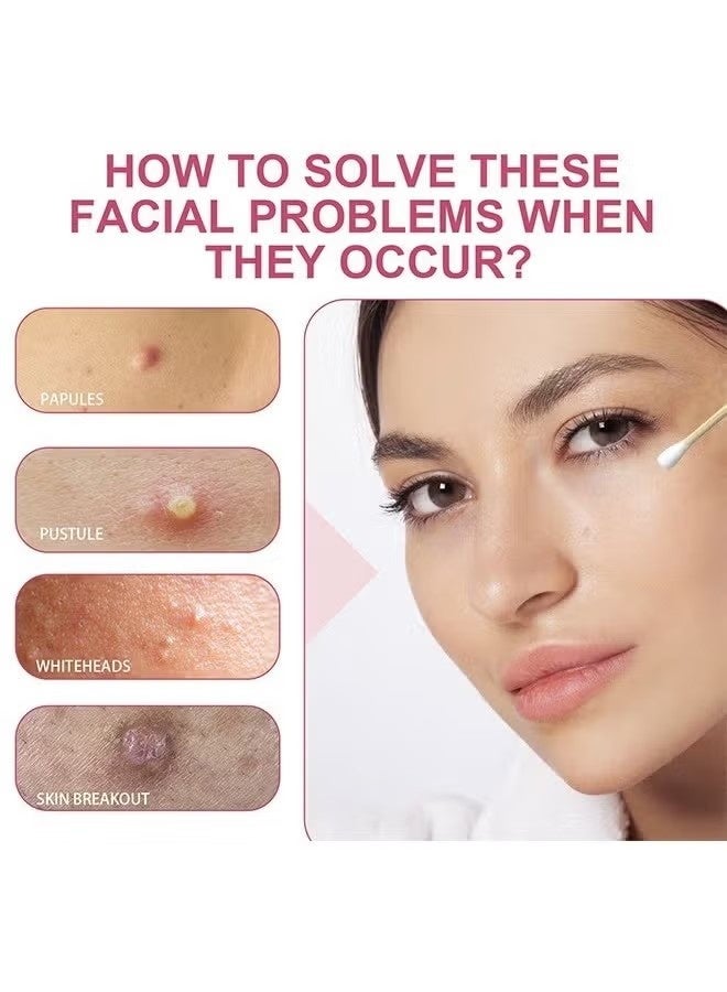 باروبت حمض الساليسيليك لوشن تجفيف حب الشباب 40ml-إصلاح حب الشباب ، يعزز إزالة حب الشباب ، لجميع أنواع الجلد - Image 3
