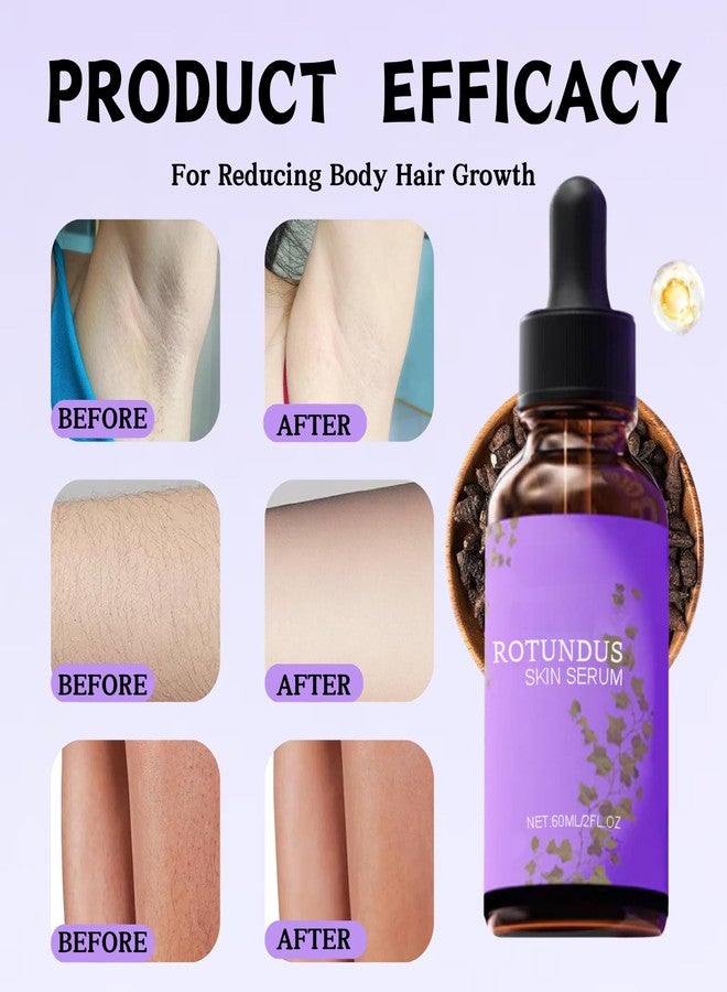 2PCS Rotundus Skin Serum,Rotundus Oil，Hair Removal Repair Essence, Natural Moisturizing Body Oil, Soothe And Gentle, Suitable For All Skin Types. - Image 2