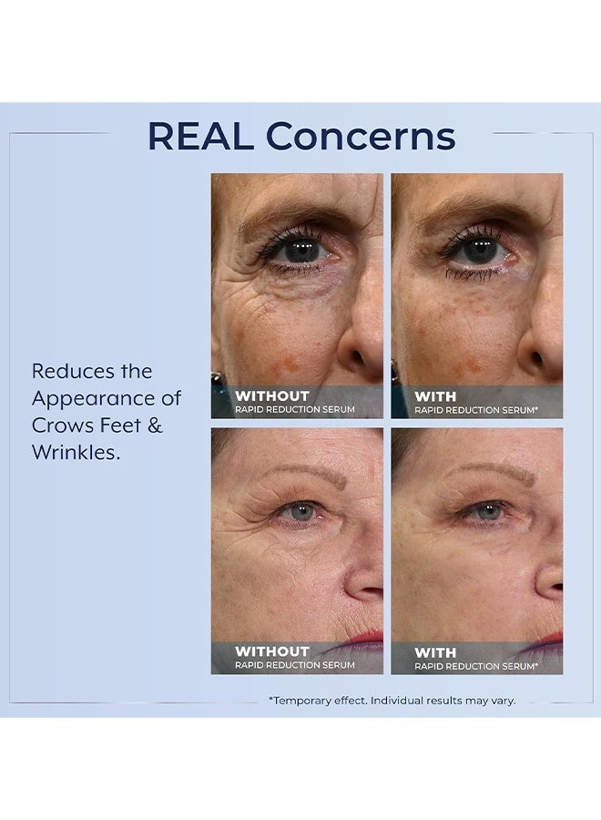 Plexaderm Rapid Reduction Eye Serum, Visibly Reduces Under-Eye Bags, Wrinkles, Dark Circles, Fine Lines & Crow's Feet Instantly, Anti Aging Wrinkle Remover For Face, Full Size Tube - Image 5