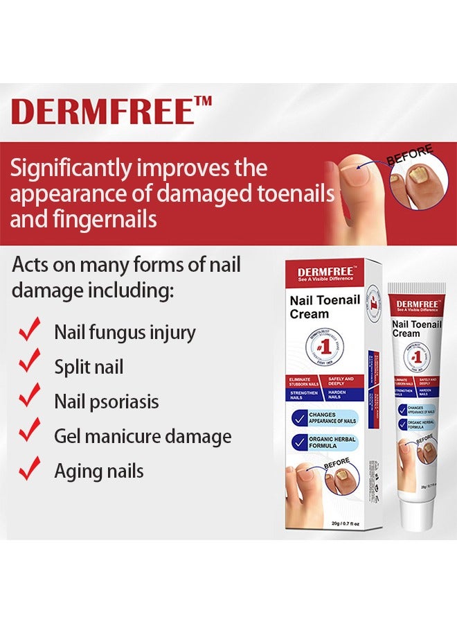 DERMFREE Nail Toenail Cream，Nail Repair Cream, 20g Nail Cream Anti Harmful Substance Repair Finger Toe Nail Care Perfect for Men and Women Home Use - Image 3