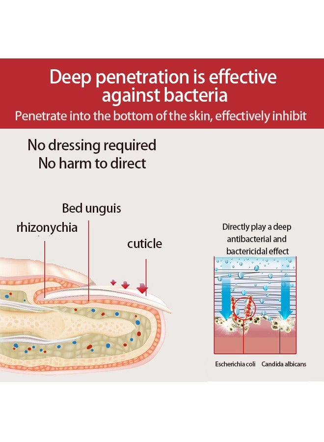 DERMFREE Nail Toenail Cream，Nail Repair Cream, 20g Nail Cream Anti Harmful Substance Repair Finger Toe Nail Care Perfect for Men and Women Home Use - Image 5