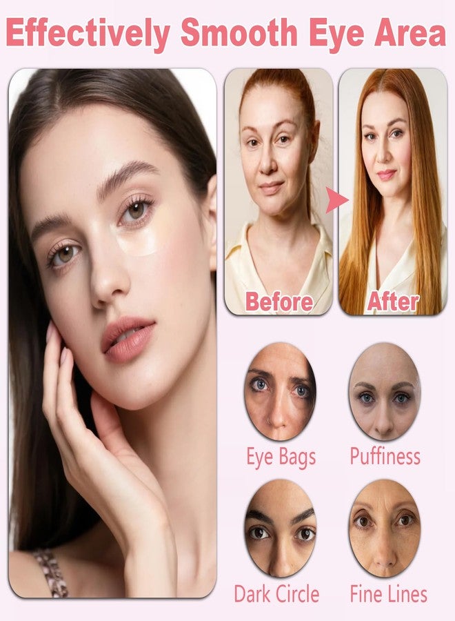 Charunee Micro Eye Patches, Under Eye Patches for Puffy Eyes and Dark Circles, Forehead & Smile Line Patches, Facial Anti Wrinkle Patches, Skin Care Masks for Women (6 Pairs) - Image 5
