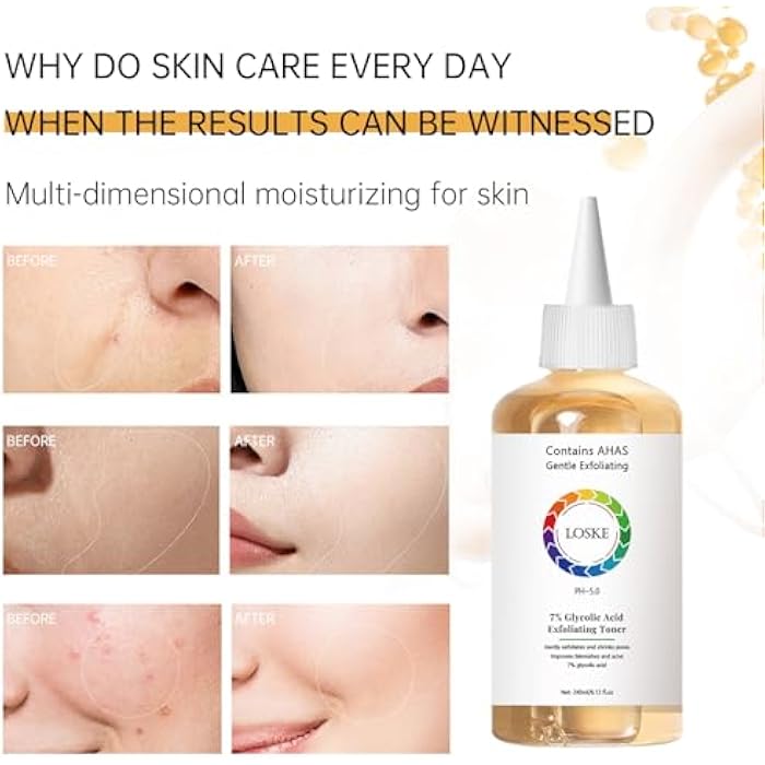 Loske 7% Glycolic Acid Face Exfoliating Toner for Clear Skin, Pore Minimizer, Radiant Complexion Enhancer, Daily Use Gentle Formula Suitable for All Skin Types - Image 5