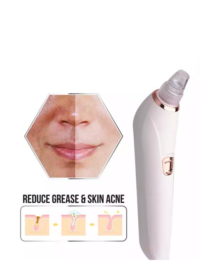 6-in-1 Pore Cleaner & Skin Vacuum – Blackhead Remover, Oil & Acne Reducer, Wrinkle Minimizer – Gentle Ergonomic Design, Adjustable Suction, Rechargeable Battery  - Image 1