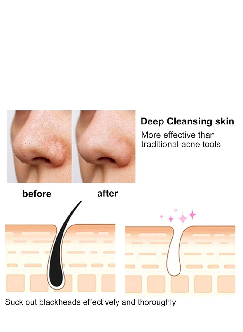 6-in-1 Pore Cleaner & Skin Vacuum – Blackhead Remover, Oil & Acne Reducer, Wrinkle Minimizer – Gentle Ergonomic Design, Adjustable Suction, Rechargeable Battery  - Image 3