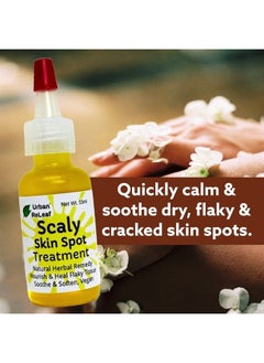Urban ReLeaf Scaly Skin Spot Treatment ! Skin Smoothing Repair Oil, Natural Relief for Flaky, Cracked, Dry Body & Face.  - Image 2