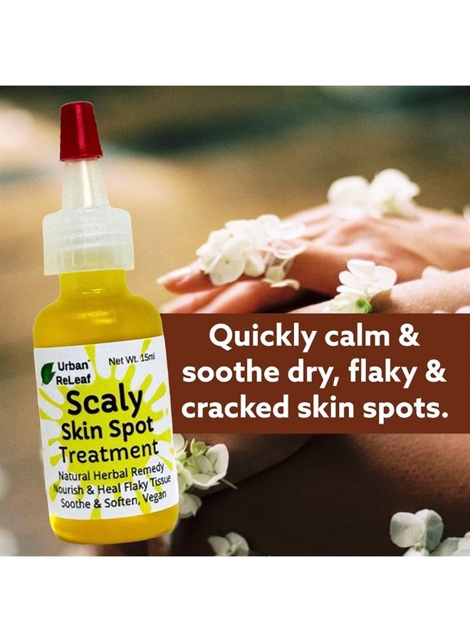 Urban ReLeaf Scaly Skin Spot Treatment ! Skin Smoothing Repair Oil, Natural Relief for Flaky, Cracked, Dry Body & Face. - Image 2