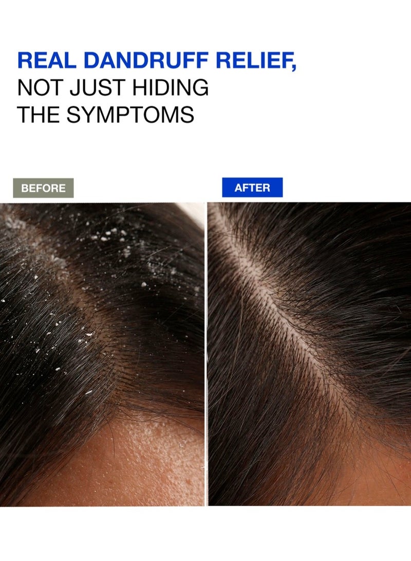 تاش شامبو ديتوكس للقشرة – لتنقية فروة الرأس وزيادة الكثافة، خالٍ من الكبريتات، 300 مل - Image 3