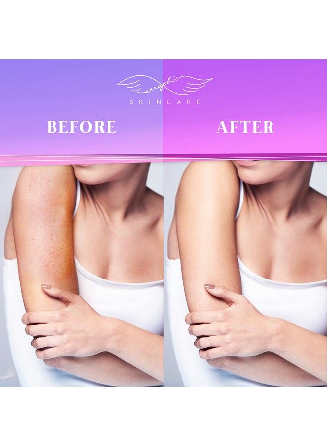 Seraphic Skincare Korean Exfoliating Mitts (2Pcs) Microdermabrasion At Home Exfoliating Gloves Visibly Lift Away Dead Skin Great For Spray Tan Removal Or Keratosis Pilaris Made Of 100% Viscose Fiber  - Image 4