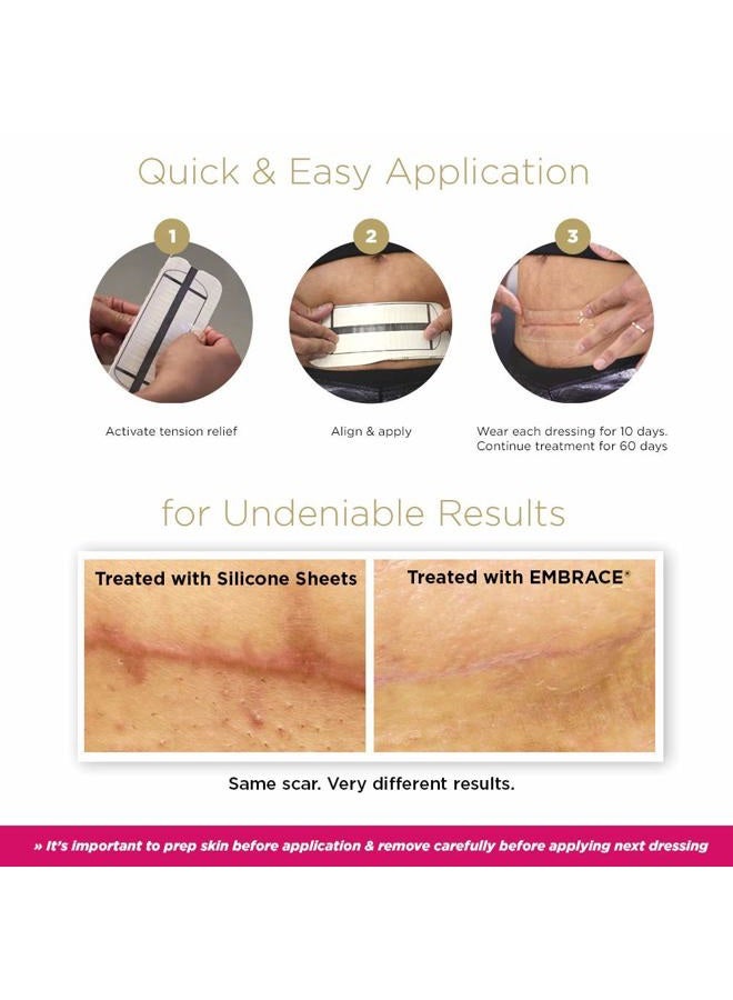 Embrace Active Scar Defense for New Scars, FDA-Cleared Silicone Scar Sheets, 2.4 Inch, Medium, 60 Day Supply (Recommended Treatment) - Image 4