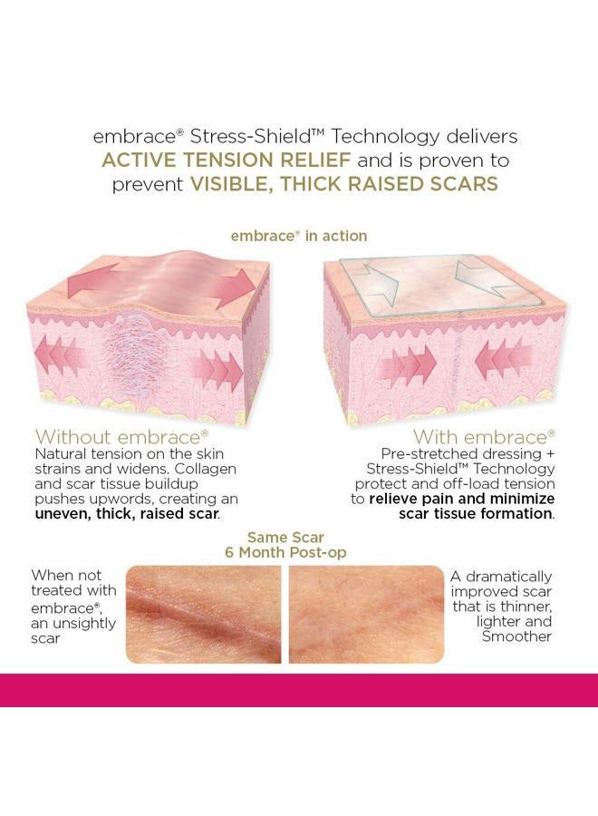 Embrace Active Scar Defense for New Scars, FDA-Cleared Silicone Scar Sheets, 2.4 Inch, Medium, 60 Day Supply (Recommended Treatment) - Image 3