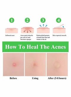 Breylee 22-Piece Invisible Acne Pimple Patch Set Clear  - Image 4
