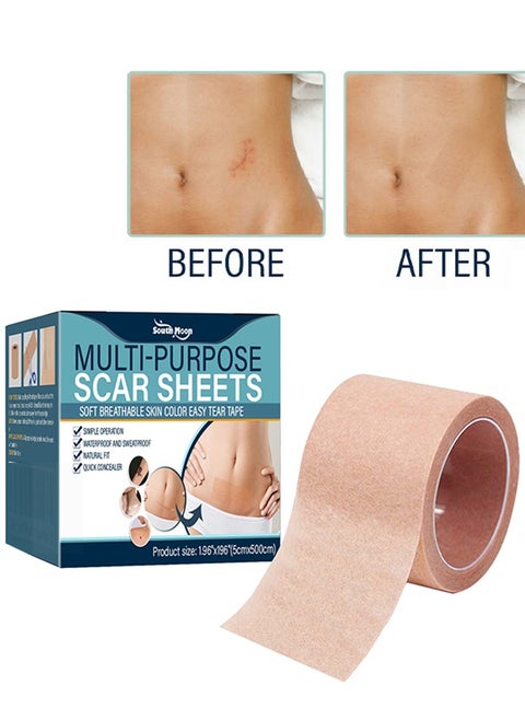 Multi Purpose Scar Sheets Soft Breathable Skin Color Easy Tear Tape,Complexion Concealer Patches , Skin Scar Tattoos Acne Scar Patches -,Waterproof Complexion Patches