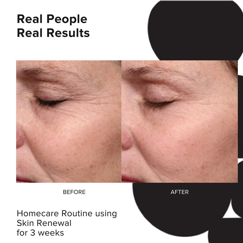 PRIORI Skincare Skin Renewal Cream with Lactic Acid Retexturizing Face Moisturizer for Dark Spots, Fine Lines & Wrinkles, Acne Scars Vitamin C, E, Fragrance Free Women & Men Skincare 1.7 fl oz - Image 4