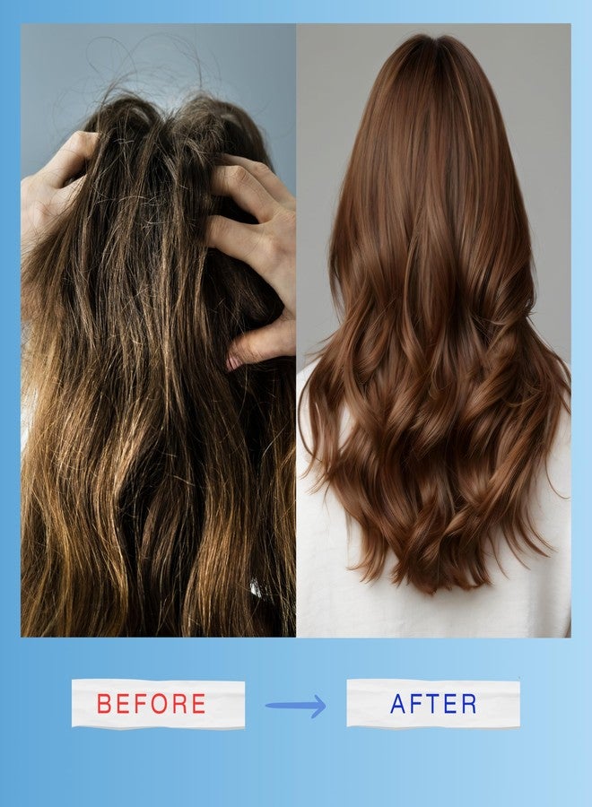 ميديسوتيكالز شامبو ميديسوتيكالز إكس-ديرما لعلاج فروة الرأس والشعر الجاف - الحجم: 250 مل - Image 5