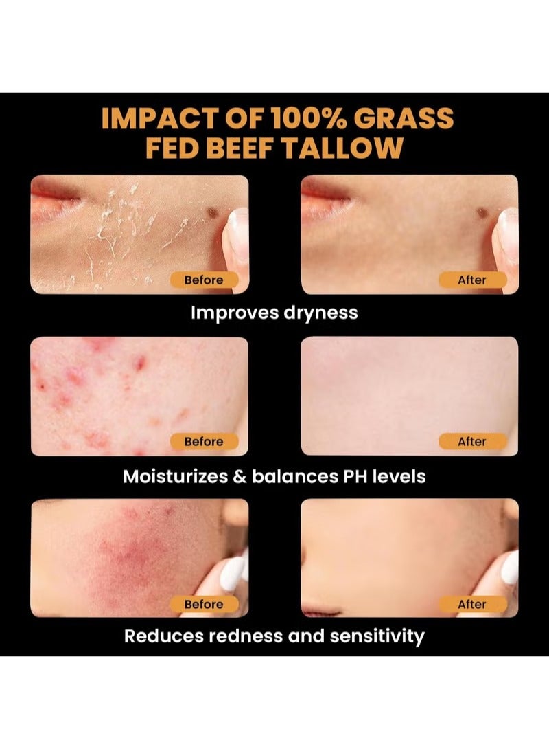 WoodSleep Tallow and Honey Balm for Face, Beef Tallow for Skin, Moisturizer with 100% Organic Grass-Fed Beef Tallow & Raw Wild Honey - Natural Formula for Dry & Sensitive Skin (59g) - Image 3