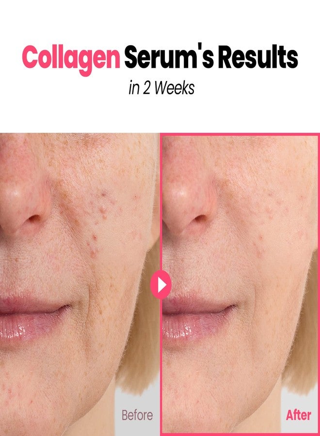 GLAM UP Plump Nourishing Dive in Real Marine Collagen Serum - Anti Aging with Hyaluronic Acid, Lifting,Tightening Skincare, Repair Skin with Peptide Complex Facial Serum 30ml (1.01 Fl Oz) - Image 4