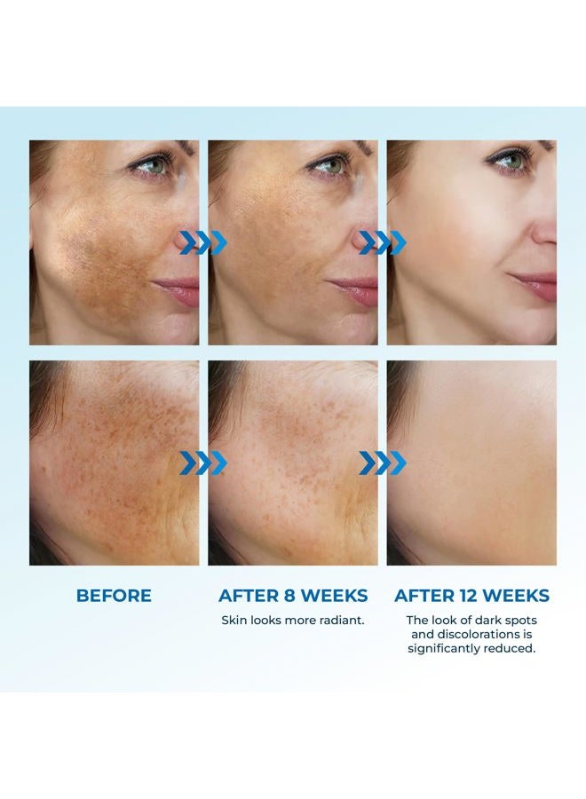Abera Dark Spot Corrector for Face, Serum for Dark Spot, Melasma & Hyperpigmentation, Boost Moisturization & Pore Minimize, All Skin Types, 0.68 fl Oz - Image 5