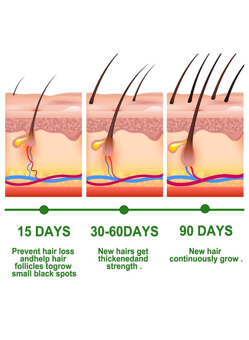 إيلهو زيت إكليل الجبل العطري لنمو الشعر والعناية بالبشرة - Image 4