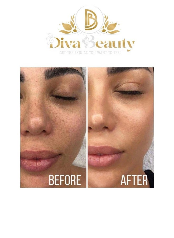 DIVA BEAUTY Avocado Night cream + Day Cream | Brightning Face cream | For Dark Spots, Uneven Skin Tone, Removes Pigmentation, Removes Pimples | (Night cream + Day Cream) - Image 3