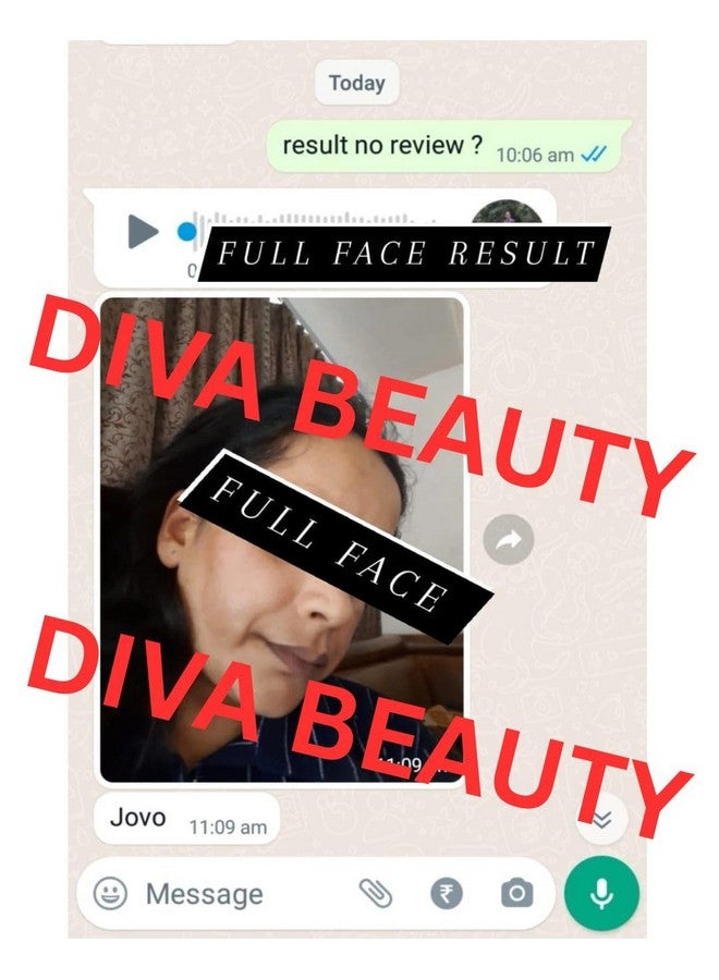 DIVA BEAUTY Avocado Night cream + Day Cream | Brightning Face cream | For Dark Spots, Uneven Skin Tone, Removes Pigmentation, Removes Pimples | (Night cream + Day Cream) - Image 5