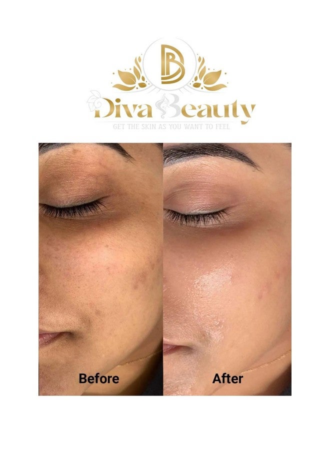 DIVA BEAUTY Avocado Night cream + Day Cream | Brightning Face cream | For Dark Spots, Uneven Skin Tone, Removes Pigmentation, Removes Pimples | (Night cream + Day Cream) - Image 4