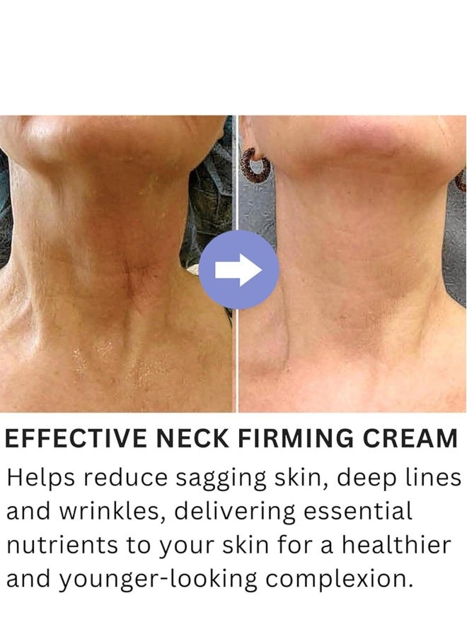 MOIKA Neck Firming Cream Tightening Lifting Sagging Skin, Tighten And Lift Neck Cream,  Tighten & Lift Firming For Crepey Skin (1PCS) - Image 4