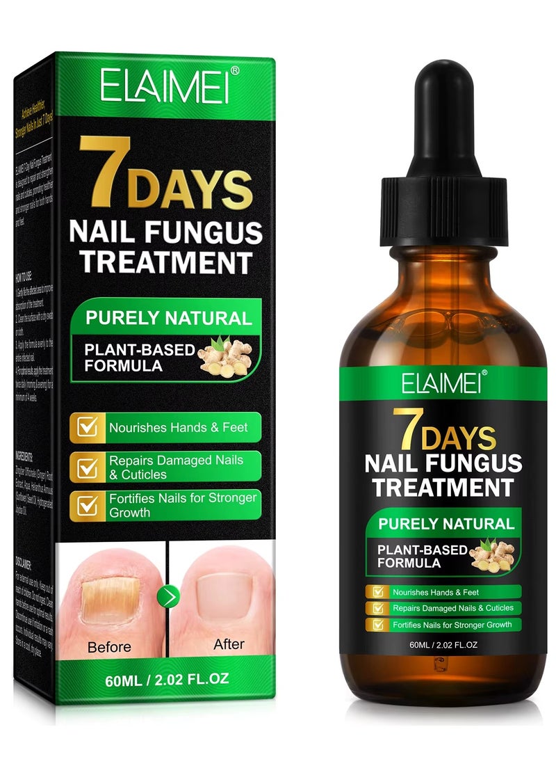 Elaimei 60ml Nail Fungus Treatment Serum Ginger Nail Growth Serum Repair & Strengthen Damaged Nails Ginger Cuticle Care Oil Deep Hydration & Nourishing Support Healthy Toenails & Fingernails - Image 1