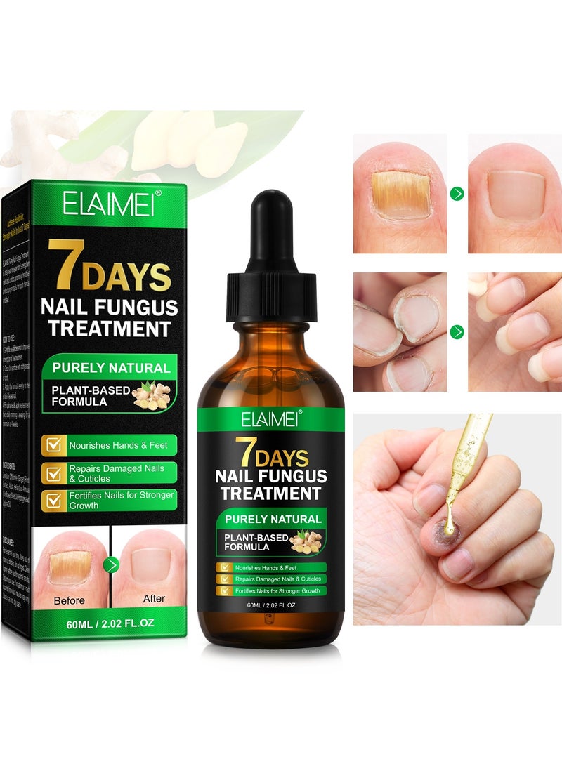 Elaimei 60ml Nail Fungus Treatment Serum Ginger Nail Growth Serum Repair & Strengthen Damaged Nails Ginger Cuticle Care Oil Deep Hydration & Nourishing Support Healthy Toenails & Fingernails - Image 2