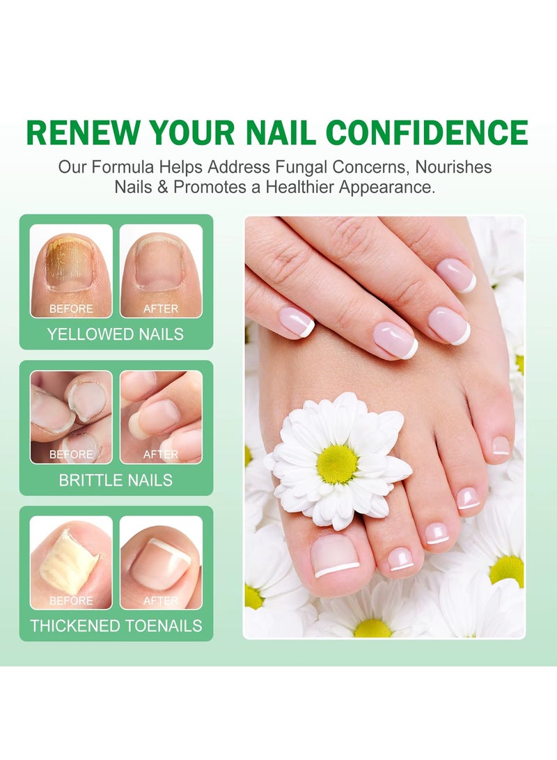 Elaimei 60ml Nail Fungus Treatment Serum Ginger Nail Growth Serum Repair & Strengthen Damaged Nails Ginger Cuticle Care Oil Deep Hydration & Nourishing Support Healthy Toenails & Fingernails - Image 4