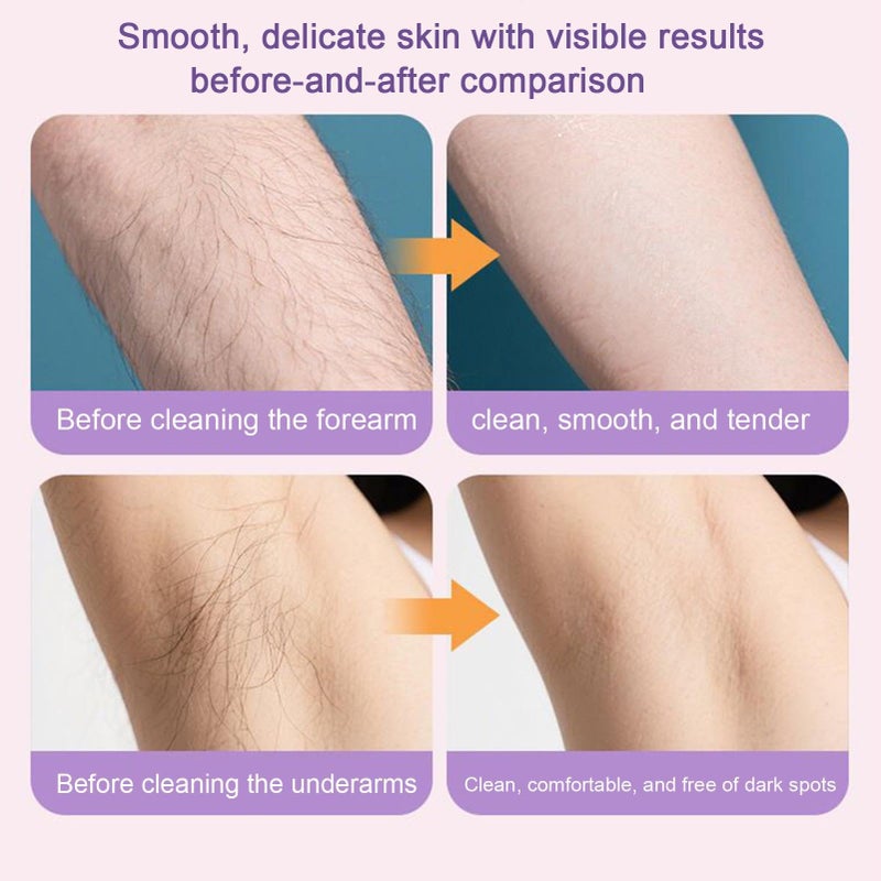 Rechargeable Cordless Body Hair Trimmer For Women Men Intimate Areas Face Arms Legs - Image 5