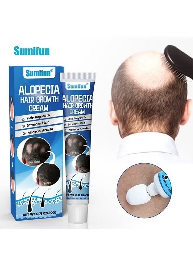 سوميفون كريم نمو الشعر Alopecia لتعزيز نمو شعر الرجال ، ومنع تساقط الشعر ، والعناية بالشعر ، 20 جرام - Image 1