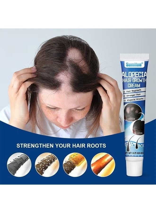 سوميفون كريم نمو الشعر Alopecia لتعزيز نمو شعر الرجال ، ومنع تساقط الشعر ، والعناية بالشعر ، 20 جرام - Image 2