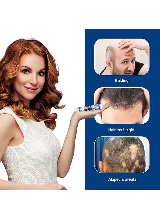 سوميفون كريم نمو الشعر Alopecia لتعزيز نمو شعر الرجال ، ومنع تساقط الشعر ، والعناية بالشعر ، 20 جرام - Image 4
