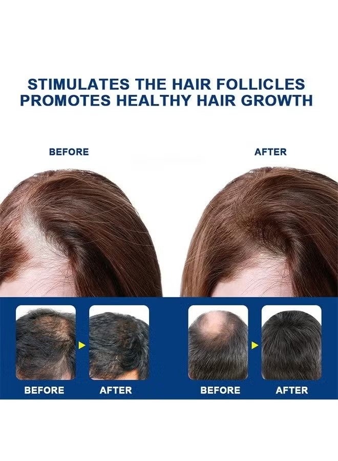 سوميفون كريم نمو الشعر Alopecia لتعزيز نمو شعر الرجال ، ومنع تساقط الشعر ، والعناية بالشعر ، 20 جرام - Image 5