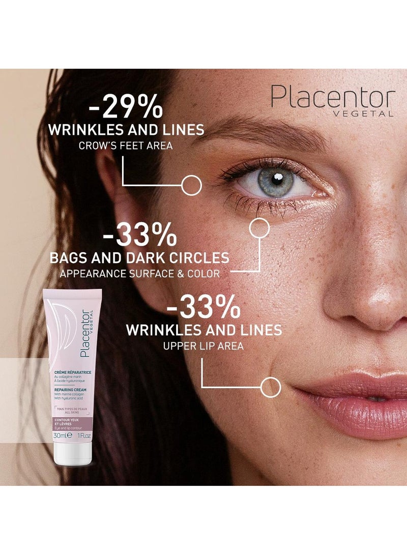 بلاسينتور فيجيتال بلاسينتور كريم مرمم لمحيط العين والشفاه - Image 3