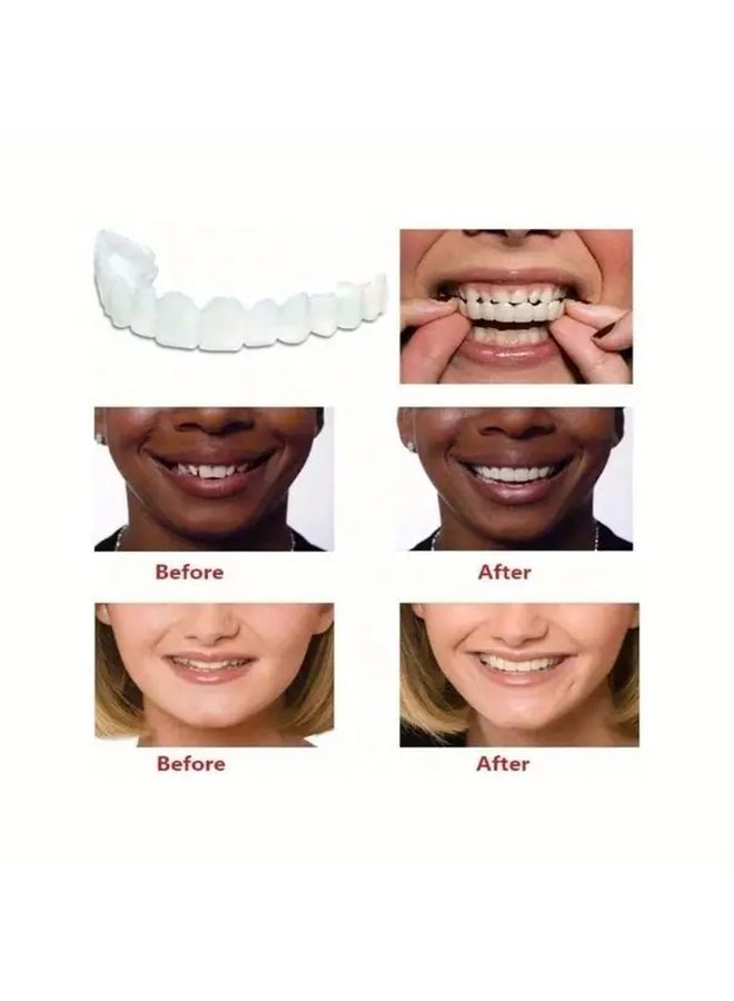 White Temporary Dentures 4pcs Upper Lower Arch Natural Looking Teeth Comfortable Adhesive Strips - Image 4