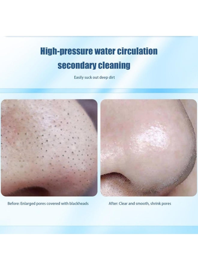 جهاز شفط لإزالة الرؤوس السوداء - مزيل الرؤوس السوداء للأنف | جهاز قابل لإعادة الشحن وقابل للتعديل لإزالة الرؤوس السوداء من الأنف للنساء والرجال - Image 3