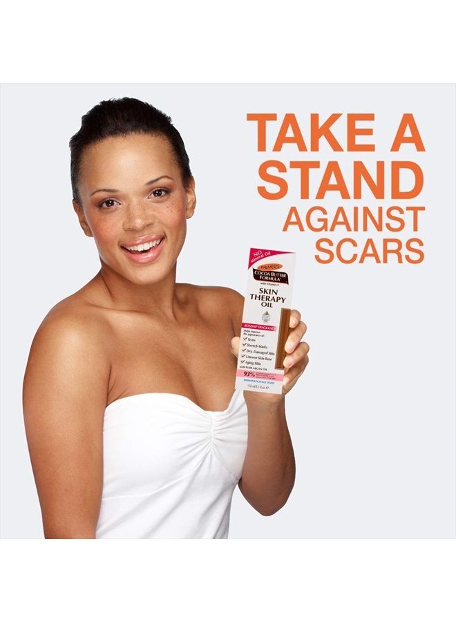 PALMERS 5.1OZ SKN THERP OIL RSE