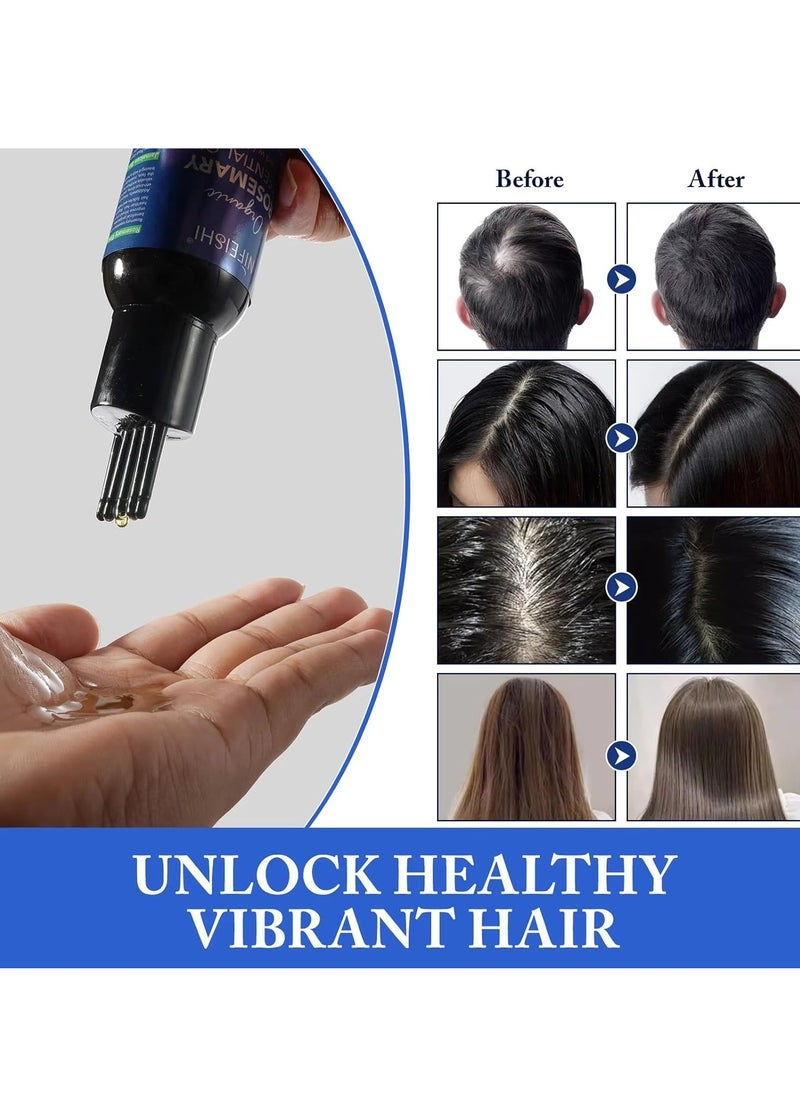 NIFEISHI - 120ml Rosemary Essential Oil with Castor Oil for Hair Growth and Skin Care Improve Blood Circulation Nourish Scalp & Prevent Hair Breakage Pure Organic Rosemary Essential Oil Infused with Castor Oil - Image 1