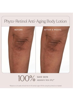 True Botanicals True Botanicals Phyto Retinol Anti-Aging Body Lotion | Targets Fine Lines, Wrinkles, Crepey Skin | Rosehip Oil & Peptilium | Dermatologist Tested, All Natural, Vegan | 4.3 oz | 127 ml  - Image 4